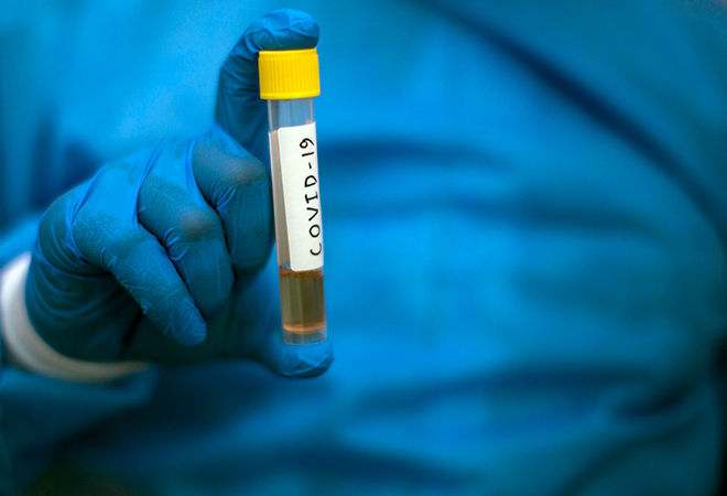 Covid-sample