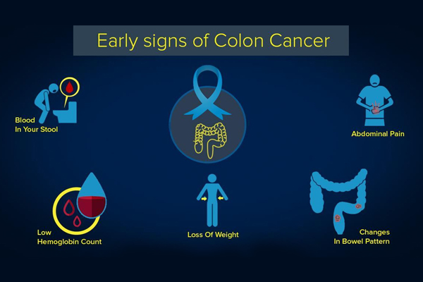 Early Stage Colon Cancer Detection, SNBNCBS of DST Comes Up with a Major Breakthrough