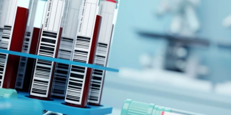 Center approves for batch testing, release of Covid Vaccines