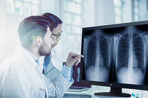 L&T Technology Services launches radiology solution Chest rAI