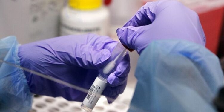 Odisha becomes first state to place order for OmiSure for Omicron detection