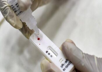 Hepatitis B and HIV diagnostic kits to boost domestic manufacturing with 5% import duty