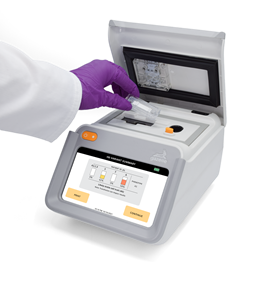 Hemex Health announces breakthrough measurement capability for clinicians monitoring sickle cell disease therapy
