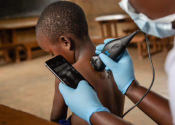 Abdul Latif Jameel Health partners Wellesta to market Butterfly iQ+in India