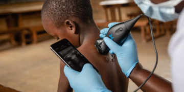 Abdul Latif Jameel Health partners Wellesta to market Butterfly iQ+in India
