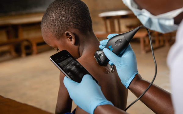 Abdul Latif Jameel Health partners Wellesta to market Butterfly iQ+in India