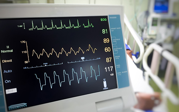 Dozee enters cardiac monitoring segment