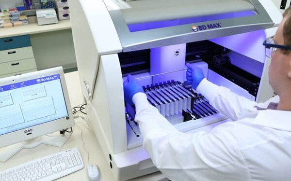 Redcliffe Labs launches BD MAX MDR TB test for detection