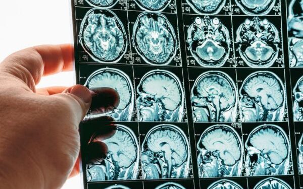 NIMHANS and NCBS receives Rs 100 crores to accelerate mental health research