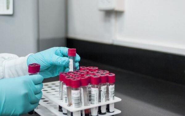 Roche Diagnostics India and CAHO launch survey for lab practice
