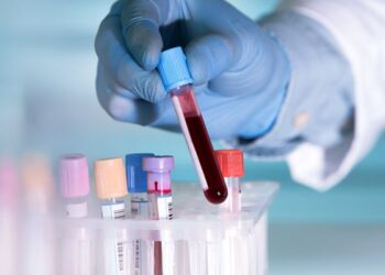 SRL Diagnostics acquires Lifeline Laboratory