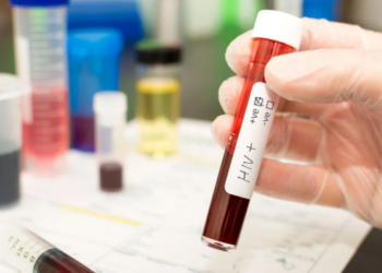 INVEX Health develops India’s first oral HIV self-test