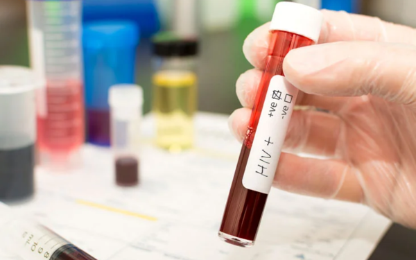 INVEX Health develops India’s first oral HIV self-test