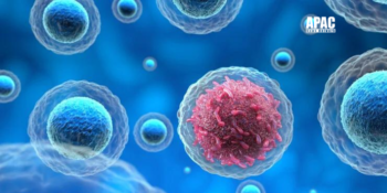 IASST Develops Advanced Model for Early Detection of Cervical Cancer