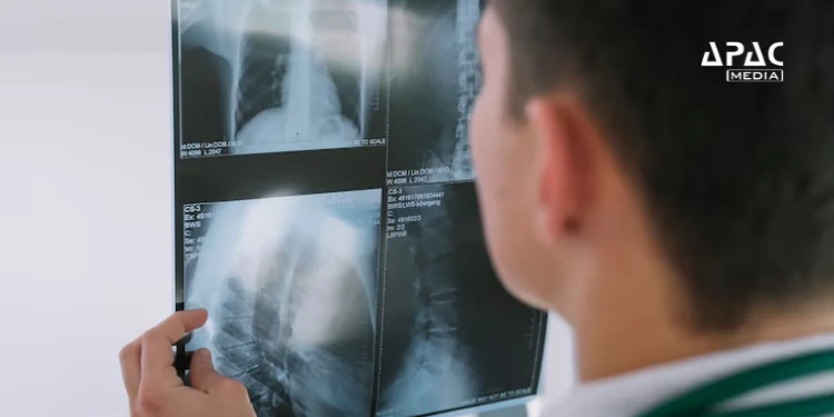 West Bengal launches 'Duare X-Ray' program, distributing 14 AI-fitted portable X-Ray machines to PHCs in remote South 24 Parganas initially. This initiative under the National Tuberculosis Elimination Program aims to provide accessible X-ray services for TB and other patients in rural areas.
